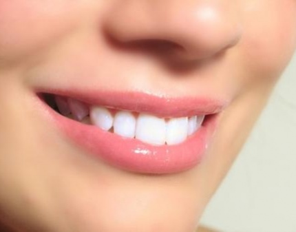 Скидка 92% на УЗ чистку всех зубов PIEZON MASTER, отбеливание и полировку! 682 р. вместо 8530 р.!