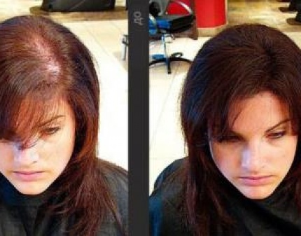 Скидка 50% на средство для роста волос BeautyHairFull! Секретная формула из Древнего Китая!